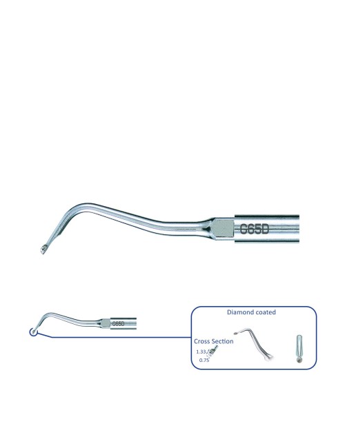 G65D PUNTA: RESTAURACIÓN G65D