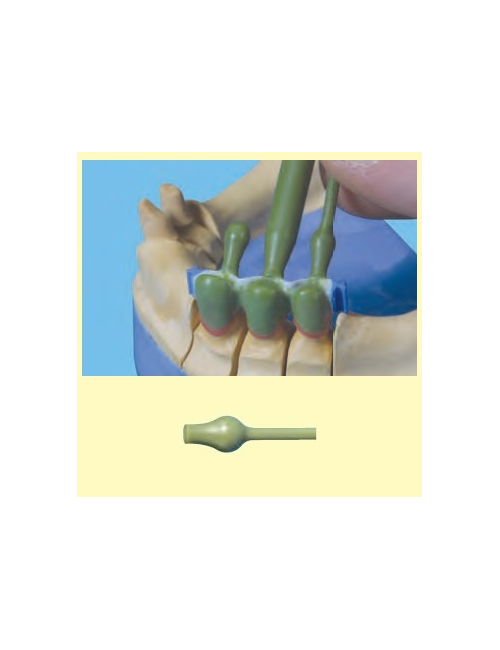 CAMARA RECHUPADO PERFIL 3mm...