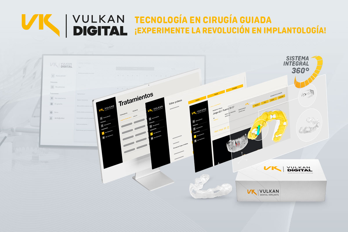 Vulkan Digital